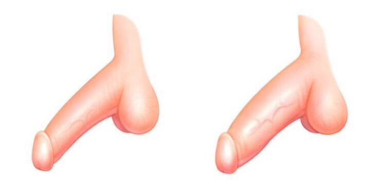 Člen před a po zvýšení